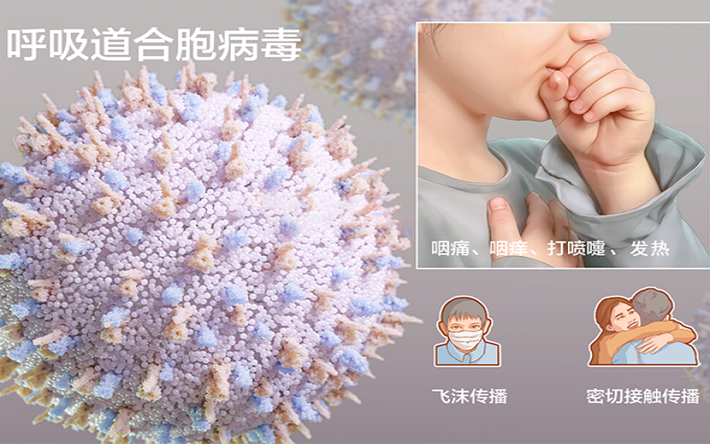 发热、鼻塞纷歧定是新冠，，，，小心人呼吸道合胞病毒熏染！